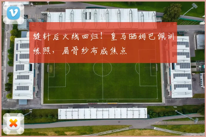 缝针后火线回归!皇马晒姆巴佩训练照,眉骨纱布成焦点